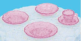 Depression Dish Set, 5Pc Pink (Dinner Plate 3/4" Diameter)